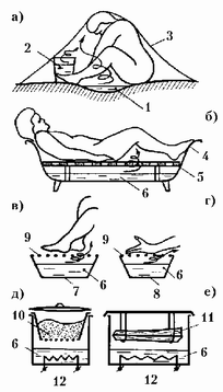 Рис. 215. Простейшие схемы пропаривания (нагрева и увлажнения конденсатом) тела